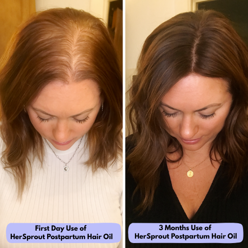Postpartum Hair Growth Oil