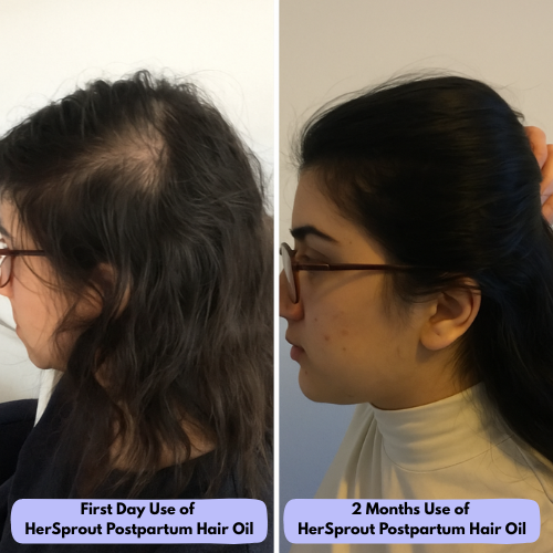Postpartum Hair Growth Oil